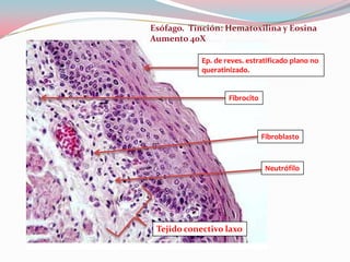 Esófago. Tinción: Hematoxilina y Eosina
Aumento 40X

            Ep. de reves. estratificado plano no
            queratinizado.


                    Fibrocito



                                Fibroblasto



                                 Neutrófilo




 Tejido conectivo laxo
 