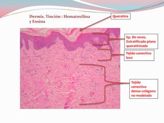 Dermis. Tinción : Hematoxilina   Queratina
y Eosina


                                        Ep. De reves.
                                        Estratificado plano
                                        queratinizado

                                        Tejido conectivo
                                        laxo




                                             Tejido
                                             conectivo
                                             denso colágeno
                                             no modelado
 