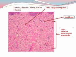 Dermis. Tinción : Hematoxilina   Fibras colágenas irregulares
y Eosina


                                                          Fibroblastos




                                                     Tejido
                                                     conectivo
                                                     denso colágeno
                                                     no modelado
 