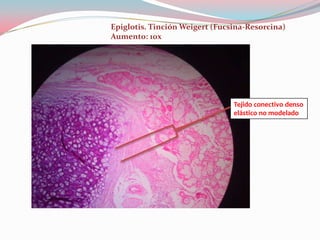 Epiglotis. Tinción Weigert (Fucsina-Resorcina)
Aumento: 10x




                                Tejido conectivo denso
                                elástico no modelado
 