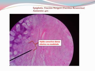 Epiglotis. Tinción Weigert (Fucsina-Resorcina)
Aumento: 40x




     Tejido conectivo denso
     elástico no modelado
 