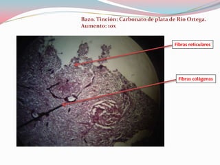 Bazo. Tinción: Carbonato de plata de Río Ortega.
Aumento: 10x


                                   Fibras reticulares




                                     Fibras colágenas
 