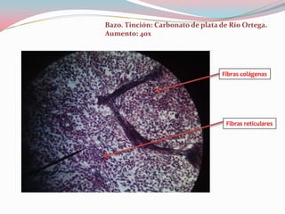 Bazo. Tinción: Carbonato de plata de Río Ortega.
Aumento: 40x




                                  Fibras colágenas




                                   Fibras reticulares
 