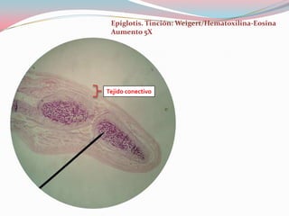 Epiglotis. Tinción: Weigert/Hematoxilina-Eosina
 Aumento 5X




Tejido conectivo
 