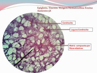 Epiglotis. Tinción: Weigert/Hematoxilina-Eosina
Aumento 5X



                     Condrocito


                             Laguna Condrocito




                           Matriz compuesta por
                           fibras elásticas
 