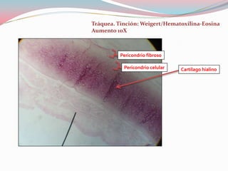 Tráquea. Tinción: Weigert/Hematoxilina-Eosina
Aumento 10X



          Pericondrio fibroso

           Pericondrio celular   Cartílago hialino
 