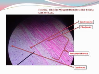 Tráquea. Tinción: Weigert/Hematoxilina-Eosina
Aumento 40X


                                   Condroblasto

                                    Fibroblasto




                         Pericondrio fibroso




                              Condrocito
 