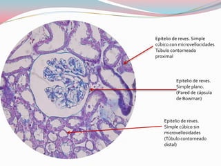 Epitelio de reves. Simple
cúbico con microvellocidades
Túbulo contorneado
proximal



         Epitelio de reves.
         Simple plano.
         (Pared de cápsula
         de Bowman)



    Epitelio de reves.
    Simple cúbico sin
    microvellosidades
    (Túbulo contorneado
    distal)
 