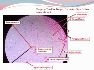 Tráquea. Tinción: Weigert/Hematoxilina-Eosina
                      Aumento 40X
                                                                  Fibroblasto

                                                            Condroblasto
Área territorial




                                                            Pericondrio fibroso



                        Grupo isógeno
                        coronario                   Pericondrio celular


                                     Grupo isógeno axial


                   Laguna cartilaginosa
 