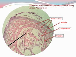 Diáfisis de feto 4 ½ meses. Tinción: Hematoxilina y
Eosina. Aumento 10x




                        Trabécula ósea

                                     Periostio


                                   Canal medular



                               Endostio
 
