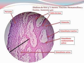 Diáfisis de feto 4 ½ meses. Tinción: Hematoxilina y
            Eosina. Aumento 40x
Periostio
                            Trabécula ósea



                                             Osteocito



                                        Osteoblasto inactivo



                                             Osteoblasto
                                             medianamente
                                             activo



                                   Osteoblasto activo
 