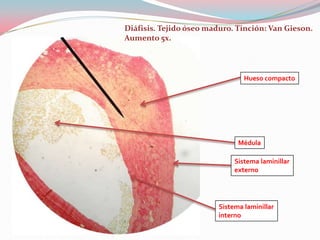 Diáfisis. Tejido óseo maduro. Tinción: Van Gieson.
Aumento 5x.




                                 Hueso compacto




                               Médula

                              Sistema laminillar
                              externo




                         Sistema laminillar
                         interno
 