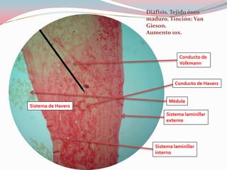 Diáfisis. Tejido óseo
                    maduro. Tinción: Van
                    Gieson.
                    Aumento 10x.



                                  Conducto de
                                  Volkmann



                                Conducto de Havers


                             Médula
Sistema de Havers
                            Sistema laminillar
                            externo




                       Sistema laminillar
                       interno
 