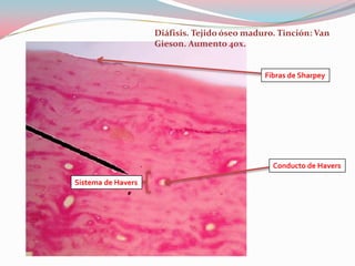Diáfisis. Tejido óseo maduro. Tinción: Van
                    Gieson. Aumento 40x.


                                              Fibras de Sharpey




                                                Conducto de Havers

Sistema de Havers
 