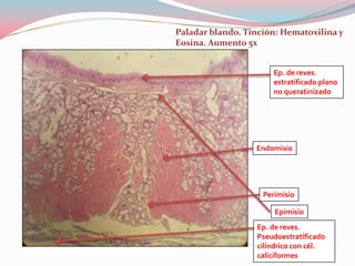 Paladar blando. Tinción: Hematoxilina y
Eosina. Aumento 5x


                       Ep. de reves.
                       estratificado plano
                       no queratinizado




                  Endomisio




                    Perimisio

                       Epimisio
                  Ep. de reves.
                  Pseudoestratificado
                  cilíndrico con cél.
                  caliciformes
 