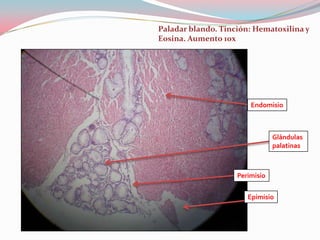 Paladar blando. Tinción: Hematoxilina y
Eosina. Aumento 10x




                        Endomisio



                                Glándulas
                                palatinas



                    Perimisio


                       Epimisio
 