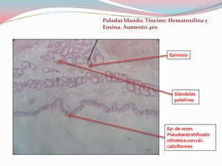 Paladar blando. Tinción: Hematoxilina y
Eosina. Aumento 40x




                        Epimisio




                          Glándulas
                          palatinas




                       Ep. de reves.
                       Pseudoestratificado
                       cilíndrico con cél.
                       caliciformes
 