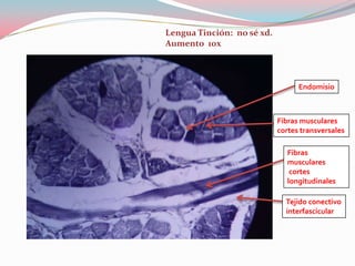 Lengua Tinción: no sé xd.
Aumento 10x



                                  Endomisio



                            Fibras musculares
                            cortes transversales

                               Fibras
                               musculares
                                cortes
                               longitudinales

                              Tejido conectivo
                              interfascicular
 