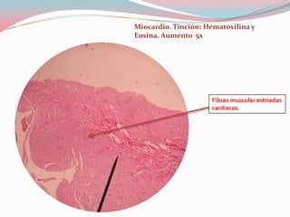 Miocardio. Tinción: Hematoxilina y
Eosina. Aumento 5x




                     Fibras muscular estriadas
                     cardiacas.
 