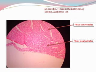 Miocardio. Tinción: Hematoxilina y
Eosina. Aumento 10x




                         Fibras transversales




                        Fibras longitudinales
 