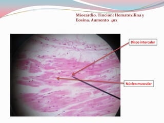 Miocardio. Tinción: Hematoxilina y
Eosina. Aumento 40x




                           Disco intercalar




                        Núcleo muscular
 