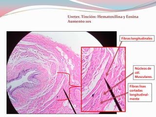 Ureter. Tinción: Hematoxilina y Eosina
Aumento 10x



                            Fibras longitudinales




                                     Núcleos de
                                     cél.
                                     Musculares.

                                 Fibras lisas
                                 cortadas
                                 longitudinal-
                                 mente
 