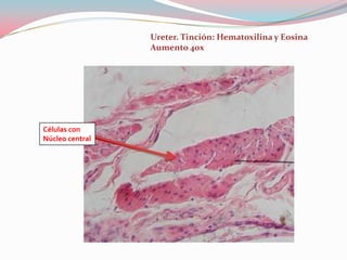 Ureter. Tinción: Hematoxilina y Eosina
                 Aumento 40x




Células con
Núcleo central
 