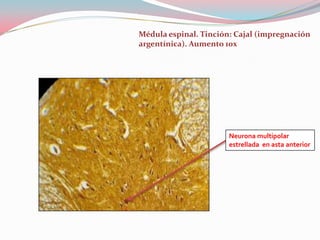 Médula espinal. Tinción: Cajal (impregnación
argentínica). Aumento 10x




                       Neurona multipolar
                       estrellada en asta anterior
 