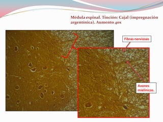 Médula espinal. Tinción: Cajal (impregnación
argentínica). Aumento 40x



                          Fibras nerviosas




                                  Axones
                                  mielínicos.
 