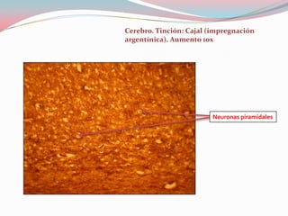 Cerebro. Tinción: Cajal (impregnación
argentínica). Aumento 10x




                         Neuronas piramidales
 