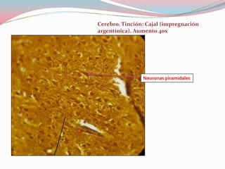 Cerebro. Tinción: Cajal (impregnación
argentínica). Aumento 40x




                Neuronas piramidales
 