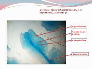 Cerebelo. Tinción: Cajal (impregnación
argentínica). Aumento 5x




                            Capa molecular

                             Capa de cél. de
                             Purkinje

                             Capa granulosa




                             Sustancia blanca
 