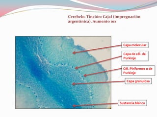 Cerebelo. Tinción: Cajal (impregnación
argentínica). Aumento 10x




                             Capa molecular

                             Capa de cél. de
                             Purkinje


                             Cél. Piriformes o de
                             Purkinje

                               Capa granulosa




                           Sustancia blanca
 