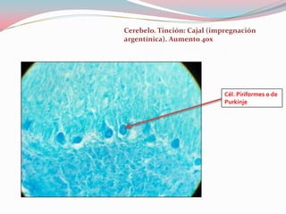 Cerebelo. Tinción: Cajal (impregnación
argentínica). Aumento 40x




                            Cél. Piriformes o de
                            Purkinje
 