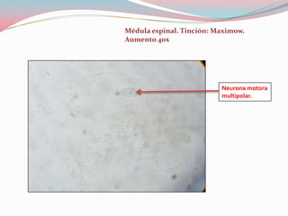 Médula espinal. Tinción: Maximow.
Aumento 40x




                          Neurona motora
                          multipolar.
 