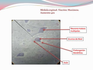 Médula espinal. Tinción: Maximow.
Aumento 40x




                          Neurona motora
                          multipolar.


                       Grumos de Nissl




                            Prolongación
                            Dendrítica.



                   Axón
 