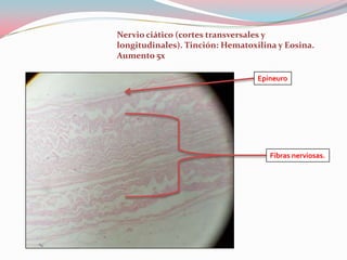 Nervio ciático (cortes transversales y
longitudinales). Tinción: Hematoxilina y Eosina.
Aumento 5x

                                  Epineuro




                                     Fibras nerviosas.
 