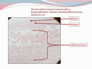Nervio ciático (cortes transversales y
longitudinales). Tinción: Hematoxilinay Eosina.
Aumento 10x
                                   Epineuro

                                   Perineuro




                                    Fibras nerviosas.
 