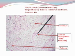 Nervio ciático (cortes transversales y
longitudinales). Tinción: Hematoxilinay Eosina.
Aumento 40x




                                      Endoneuro




                                    Axón con
                                    neuroqueratina
                                     (corte
                                    transversal)



                                      Perineuro
 