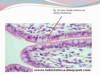 Ep. De reves. Simple cilíndrico con
células caliciformes.
 