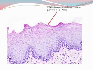 Epitelio de reves. estratificado plano no
queratinizado (esófago)
 