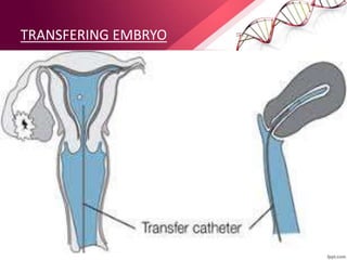 TRANSFERING EMBRYO
 
