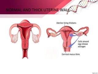 NORMAL AND THICK UTERINE WALL
 
