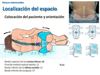 Colocación del paciente y orientación
Localización del espacio
Bloqueo subaracnoideo
C 7
Borde superior de las crestas ilíacas: L4
Final de medula espinal adulto: L1
Borde inferior de la última costilla: L2
Borde inferIor de escápula: C7
 