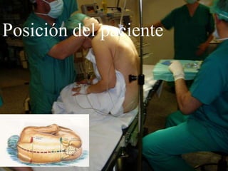 Posición del paciente
 