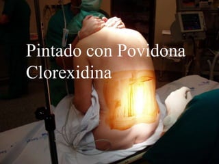 Pintado con Povidona
Clorexidina
 