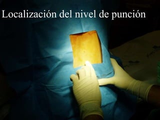 Localización del nivel de punción
 