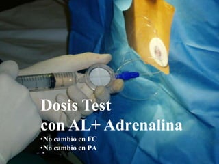 Dosis Test
con AL+ Adrenalina
•No cambio en FC
•No cambio en PA
 