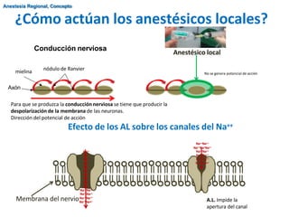 Anestésico local
Membrana del nervio A.L. Impide la
apertura del canal
No se genera potencial de acción
Axón
Para que se produzca la conducción nerviosa se tiene que producir la
despolarización de la membrana de las neuronas.
Dirección del potencial de acción
Efecto de los AL sobre los canales del Na++
Na++
Na++
Na++
Na++
Na++
Na++
Na++
Na++
Na++
Na++
Na++Na++
Na++Na++
Na Na
++ ++
Na++Na++
Na++Na++
Na++Na+Na++
Na++Na++
Na++Na++
Na++Na++
Na++Na++
Conducción nerviosa
nódulo de Ranvier
mielina
¿Cómo actúan los anestésicos locales?
Anestesia Regional, Concepto
 
