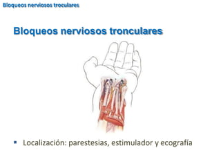  Localización: parestesias, estimulador y ecografía
Bloqueos nerviosos tronculares
Bloqueos nerviosos troculares
 